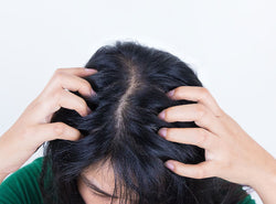 Dry Scalp Treatments - Home Remedies, Oils, Diet & More