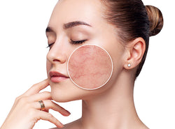 सेंसिटिव स्किन (संवेदनशील त्वचा) की देखभाल - Sensitive Skin Care Tips In Hindi